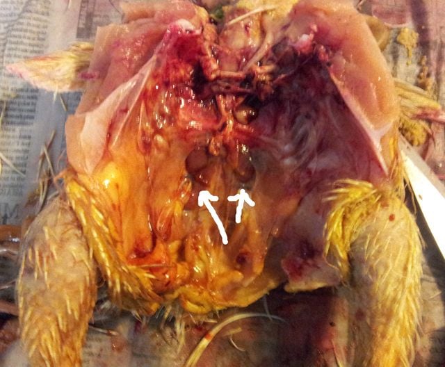 kidneyu.jpg